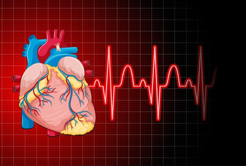 Arrhythmias